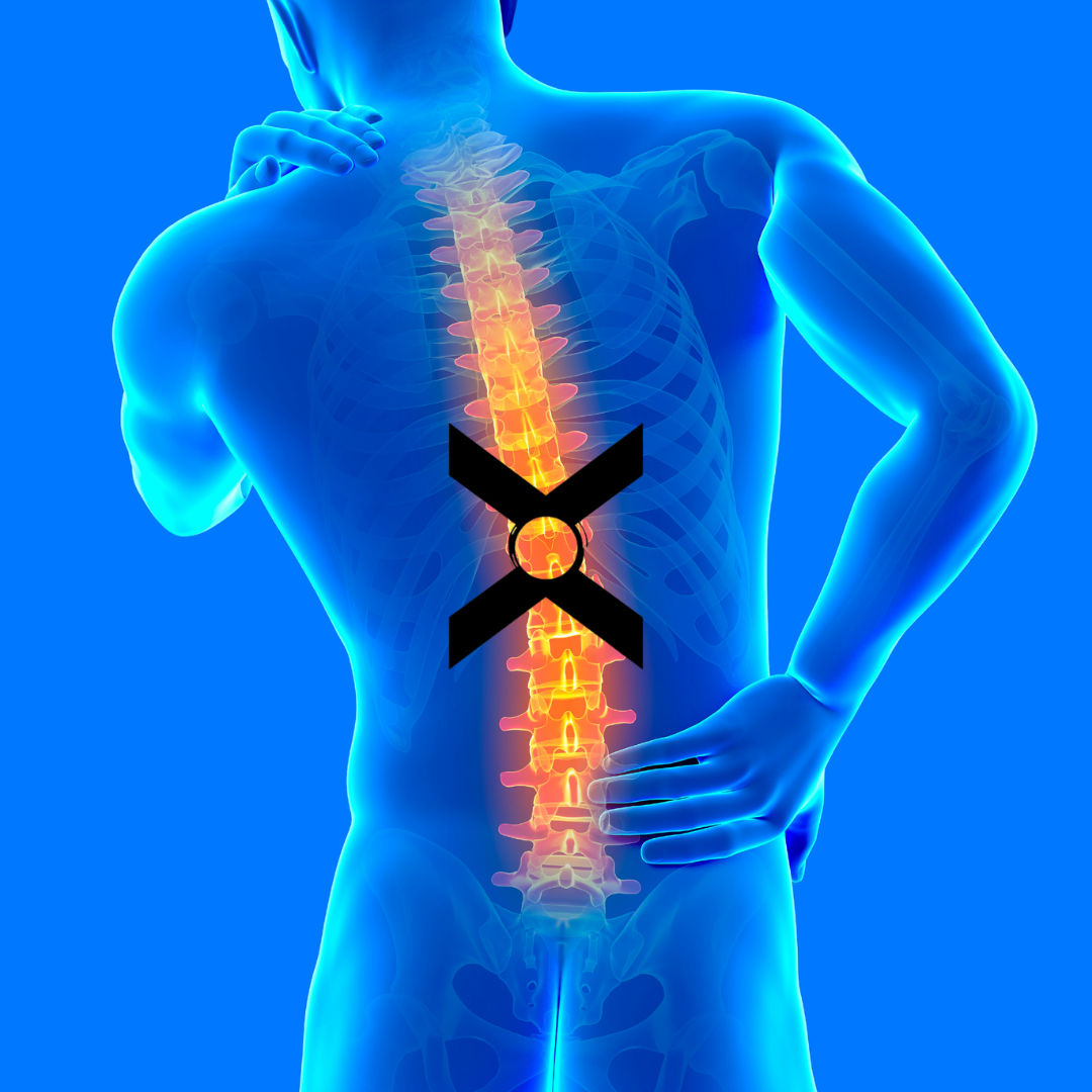 CoreX™ Back Belt