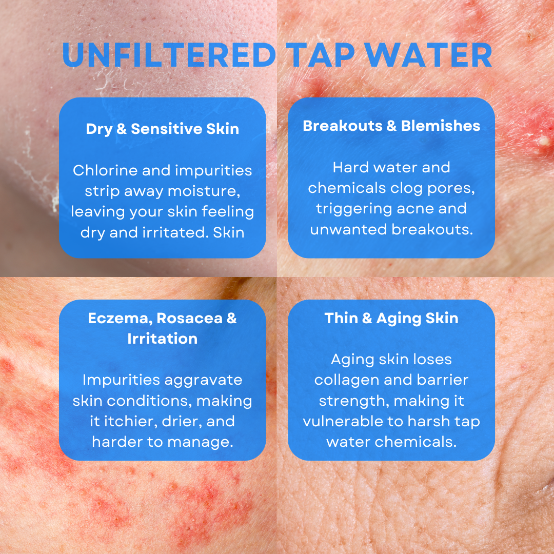 HydroFlo™ – The Ultimate Shower Filter for Healthier Skin & Hair